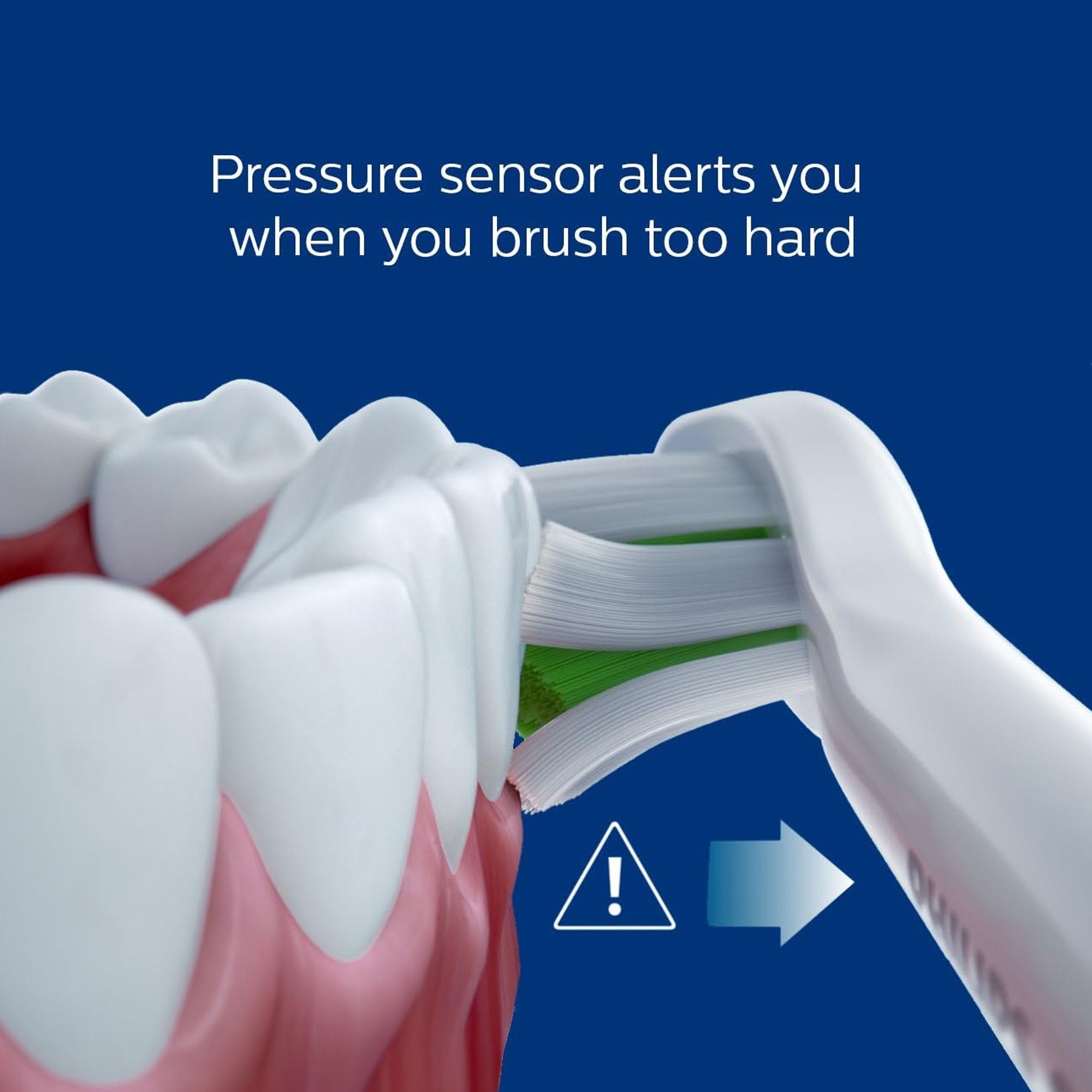 Philips Sonicare ExpertClean 7500 Rechargeable Electric Toothbrush HX9690\u002F07 (Pink)